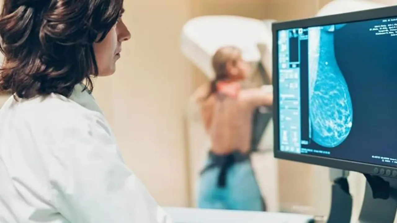 Médica especialista observa una mamografía en la pantalla mientras una paciente aguarda el estudio