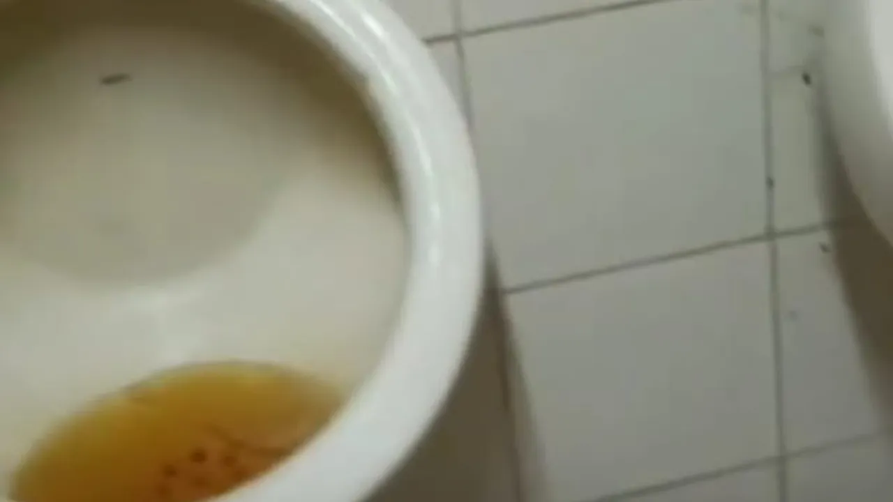 Inodoro con acumulación de orina y restos de suciedad en el piso del baño del centro asistencial público.