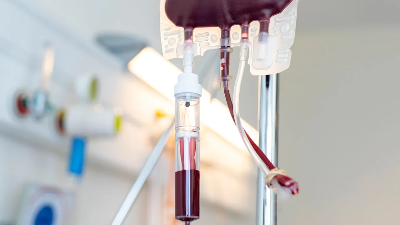 Bolsa de transfusión de sangre conectada a un tubo intravenoso en una sala médica iluminada.