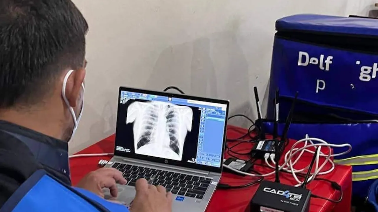 Personal sanitario analiza una radiografía de tórax en una computadora portátil junto a equipos médicos en una mesa.